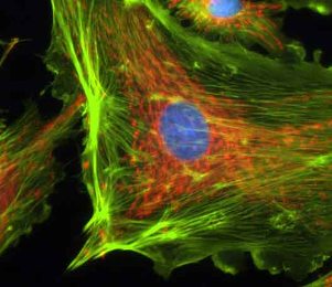 Confocal microscope image of cell